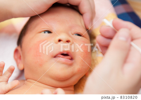 生後3週間 8310820