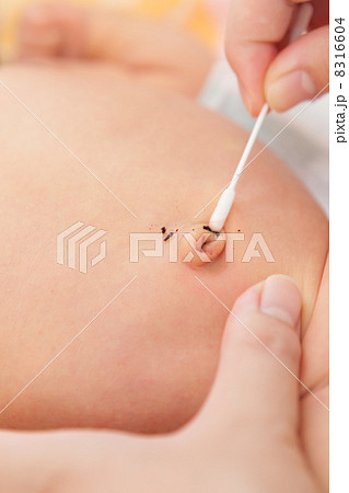 赤ちゃんのへそのお手入れ 8316604