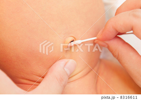 赤ちゃんのへそのお手入れ 8316611