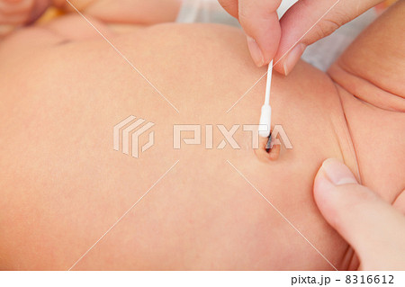 赤ちゃんのへそのお手入れ 8316612