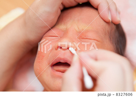 生後3週間 生後3週間 8327606