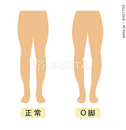 O脚 8407705
