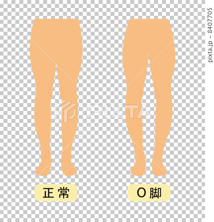 O脚 8407705