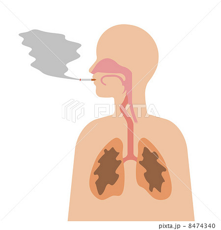 喫煙による弊害 8474340