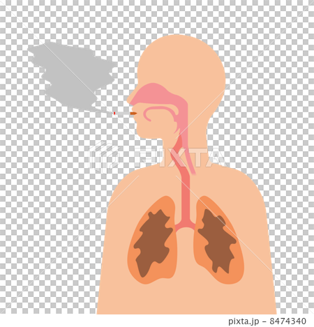 喫煙による弊害 8474340