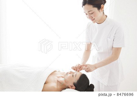 美容鍼 8476696