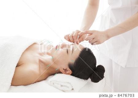 美容鍼 8476703