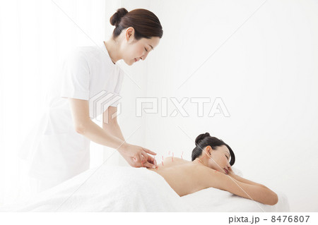 鍼治療 鍼治療 8476807