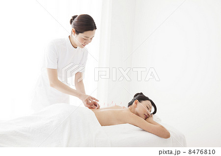 鍼治療 鍼治療 8476810