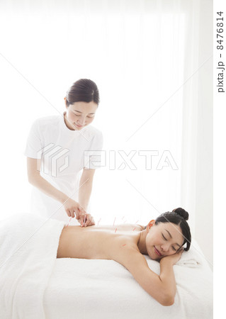 鍼治療　 8476814