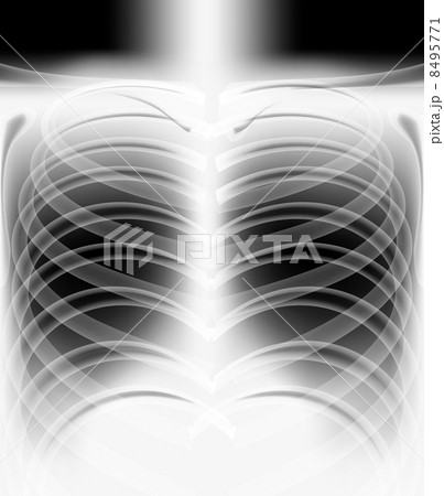 x-ray x-ray 8495771