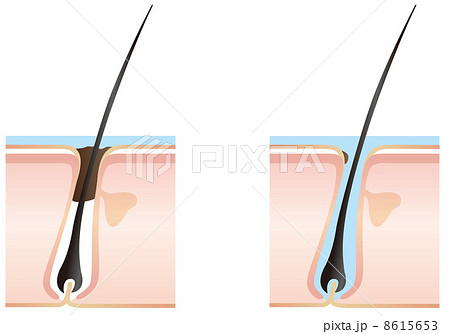 頭皮 毛根のイラストのイラスト素材