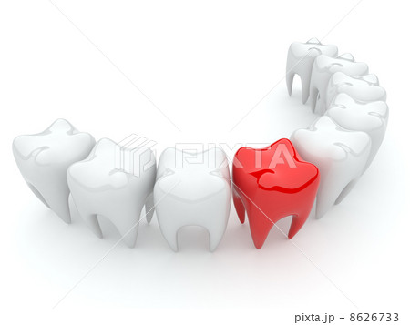 Bad tooth. 3D illustration. Isolated 8626733