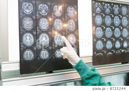 MRI MRI 8725244
