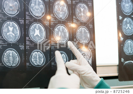 MRI MRI 8725246
