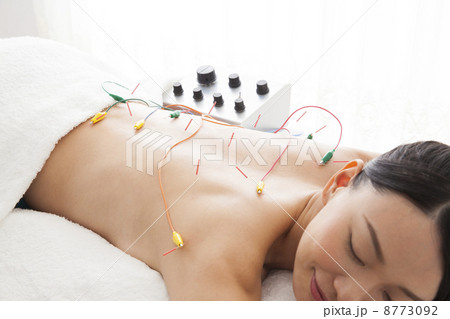 鍼治療　　　 8773092