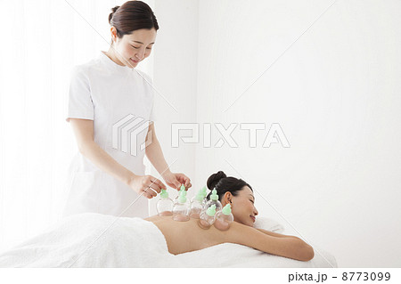 吸玉療法 吸玉療法 8773099