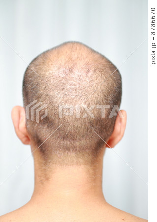 薄毛 8786670