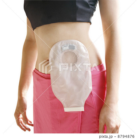 介護用品を装着した女性 介護用品を装着した女性 8794876