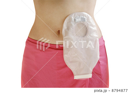 介護用品を装着した女性 介護用品を装着した女性 8794877