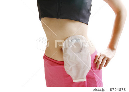 介護用品を装着した女性 介護用品を装着した女性 8794878