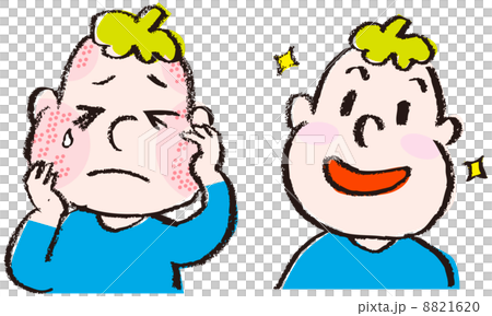 Treatment of atopy - Stock Illustration [8821620] - PIXTA