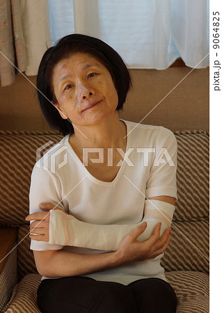 顔面と腕を怪我した女性の写真素材