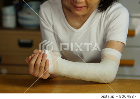 骨折をした女性の写真素材