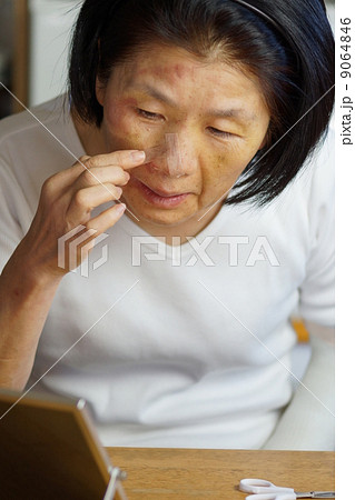顔面にけがをしてテーピングする女性の写真素材