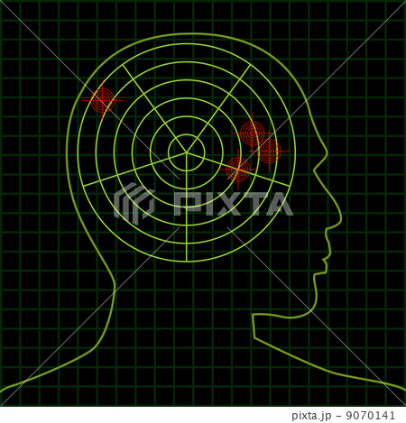 brain brain 9070141