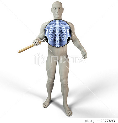 magnifier x-ray magnifier x-ray 9077893