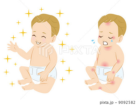 赤ちゃん　症状 9092582