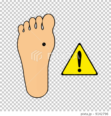 足裏のホクロに注意 9142796