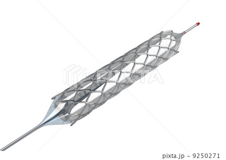 Angioplasty Angioplasty 9250271