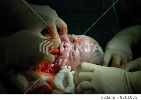 new born infant in the operation room new born infant in the operation room 9261025