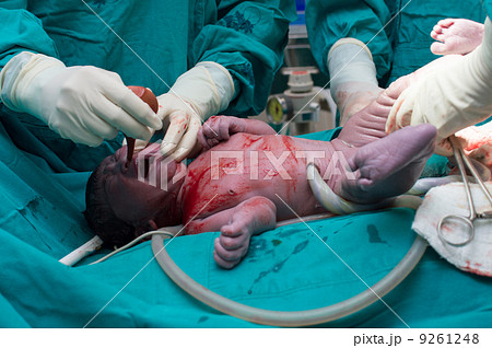 cesarean section cesarean section 9261248
