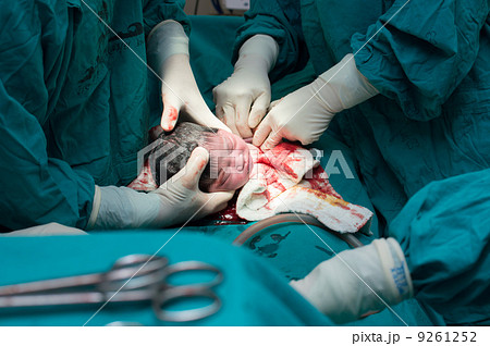 cesarean section cesarean section 9261252
