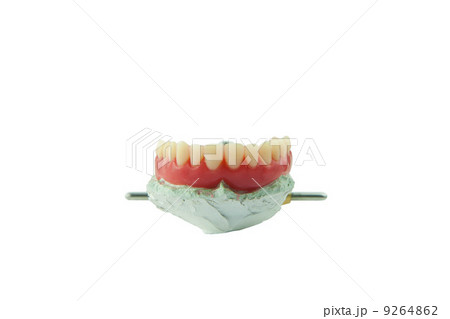 upper dental wax model 1 upper dental wax model 1 9264862