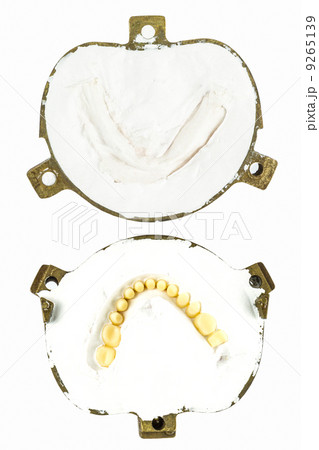 make denture plaster model make denture plaster model 9265139
