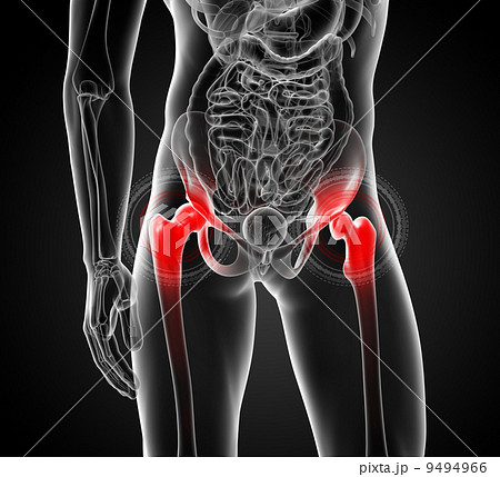 painful hip joint 9494966