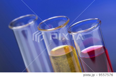 Flasks in the chemical laboratory 9557576