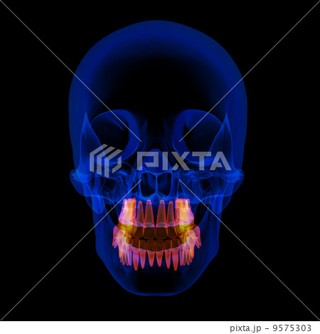human x ray skull on black background human x ray skull on black background 9575303