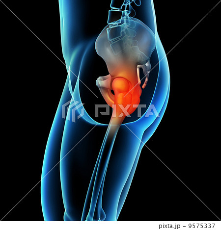 painful hip joint 9575337