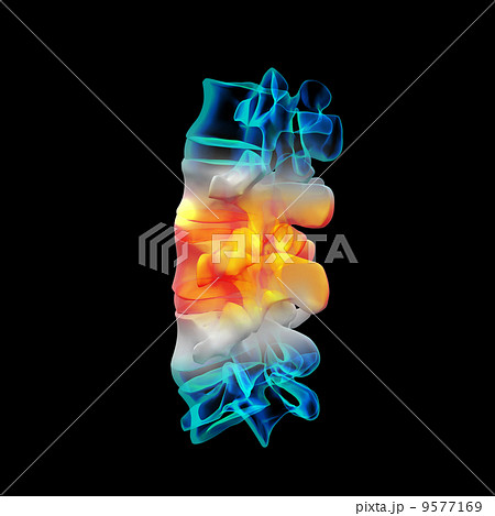 Human with the backbone 9577169