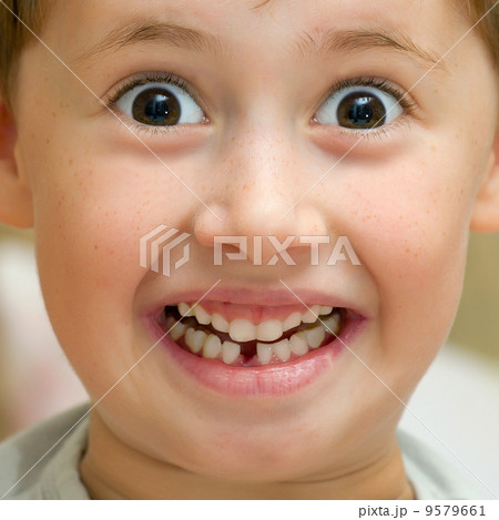 Boy smiling without one teeth Boy smiling without one teeth 9579661
