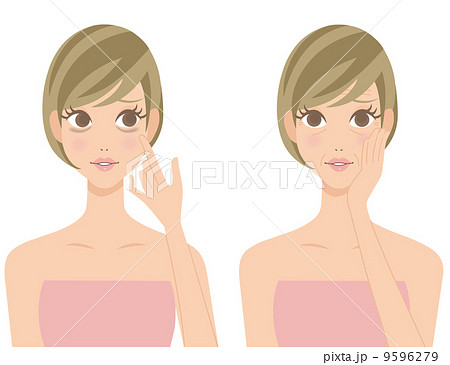 目のくま しわ 女性 目のくま しわ 女性 9596279