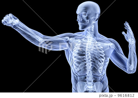 body 9616812