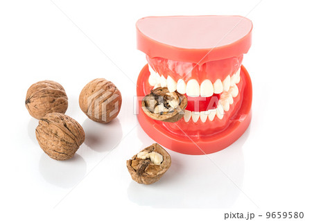 dental jaw model with walnuts 9659580