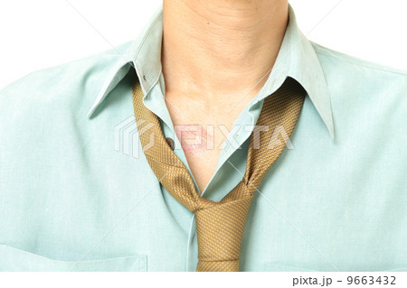 キスマークをつけた男性 9663432