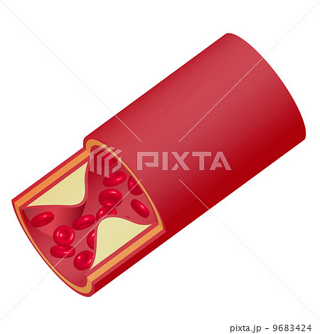 血管 血管 9683424